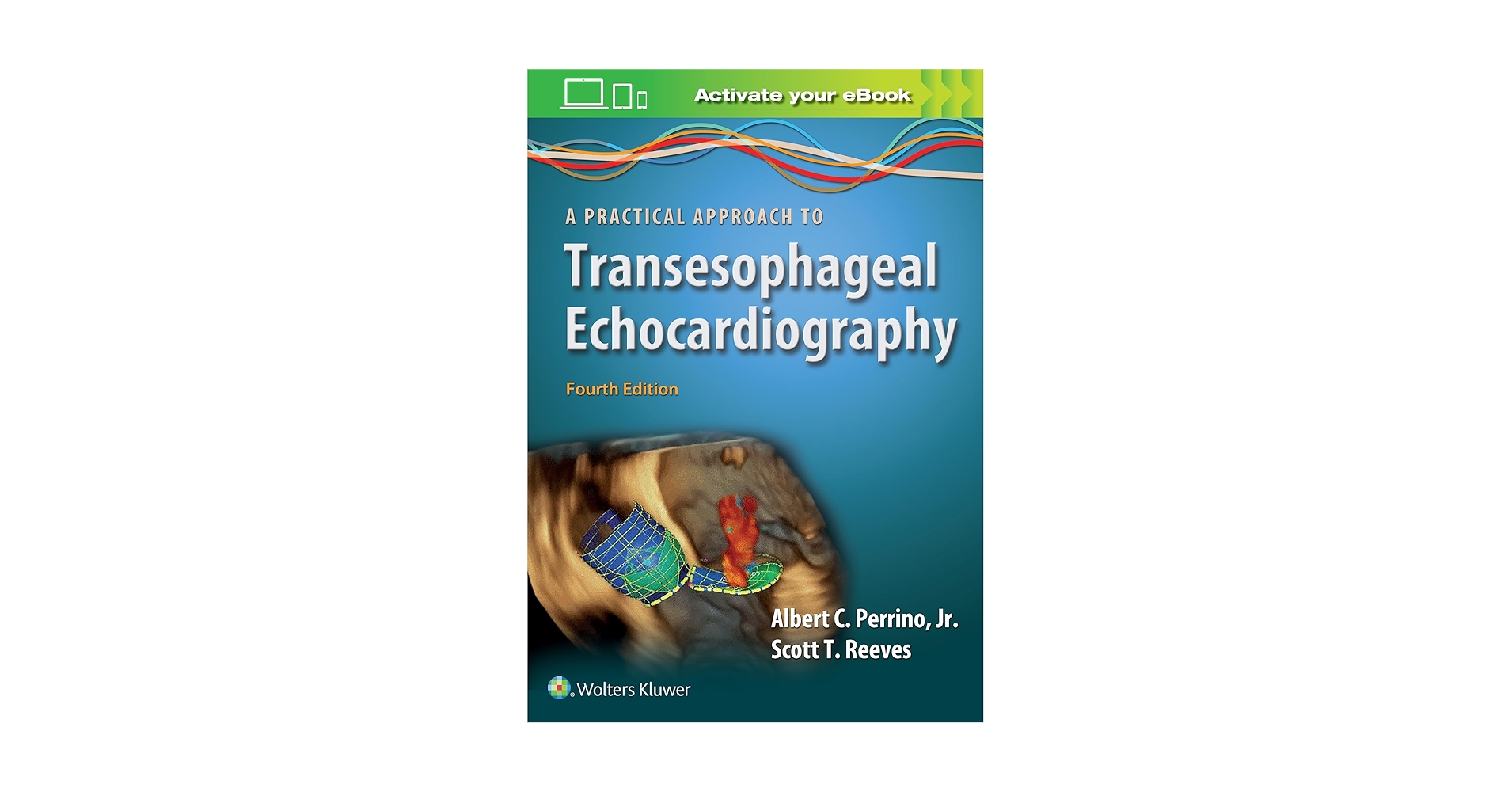 A Practical Approach to Transesophageal Echocardiography